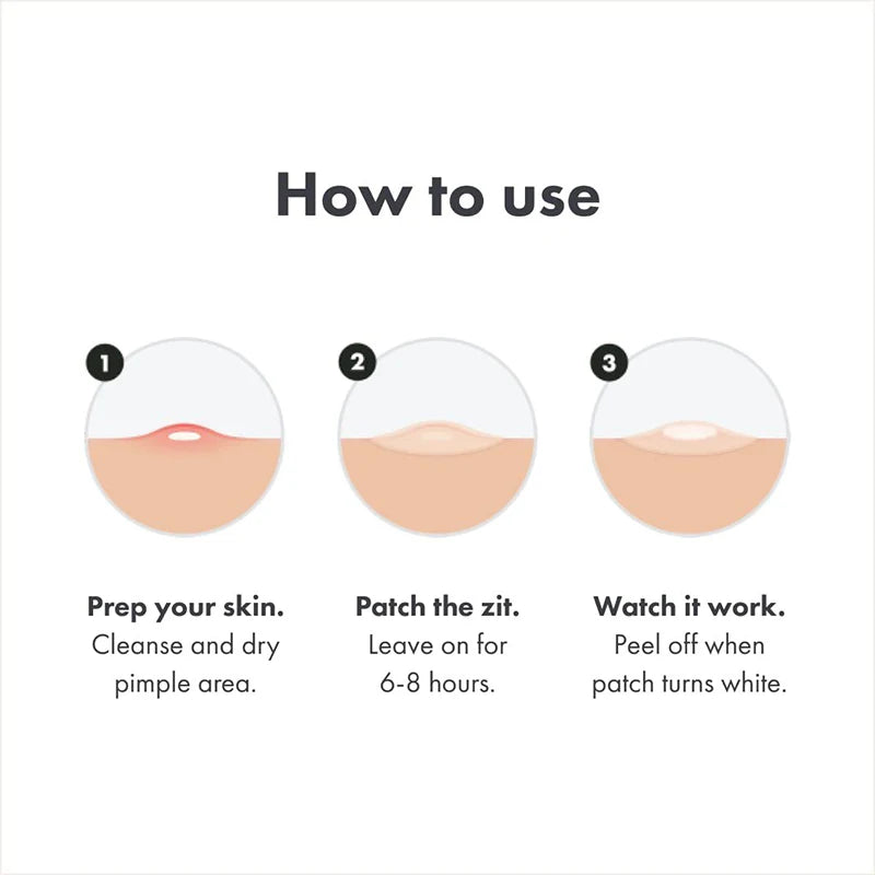 Hydrocolloid Acne Patches
