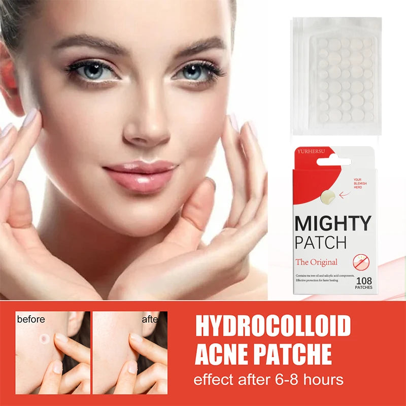 Hydrocolloid Acne Patches